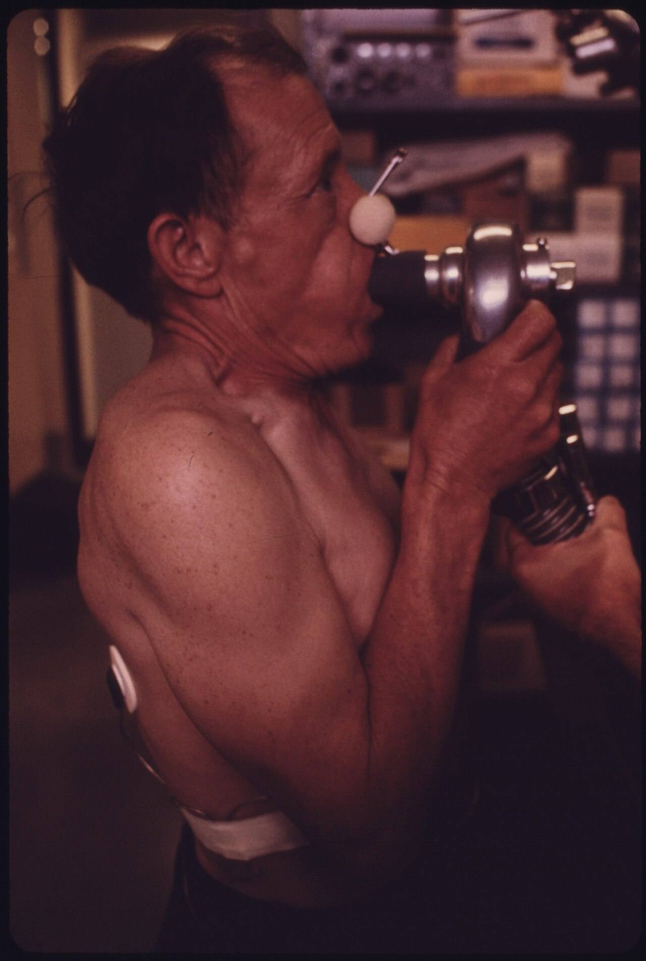 A Miner at the Black Lung Laboratory in the Appalachian Regional Hospital in Beckley, West Virginia, is Having His...